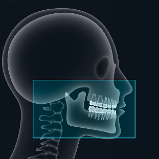 Frontal and lateral view